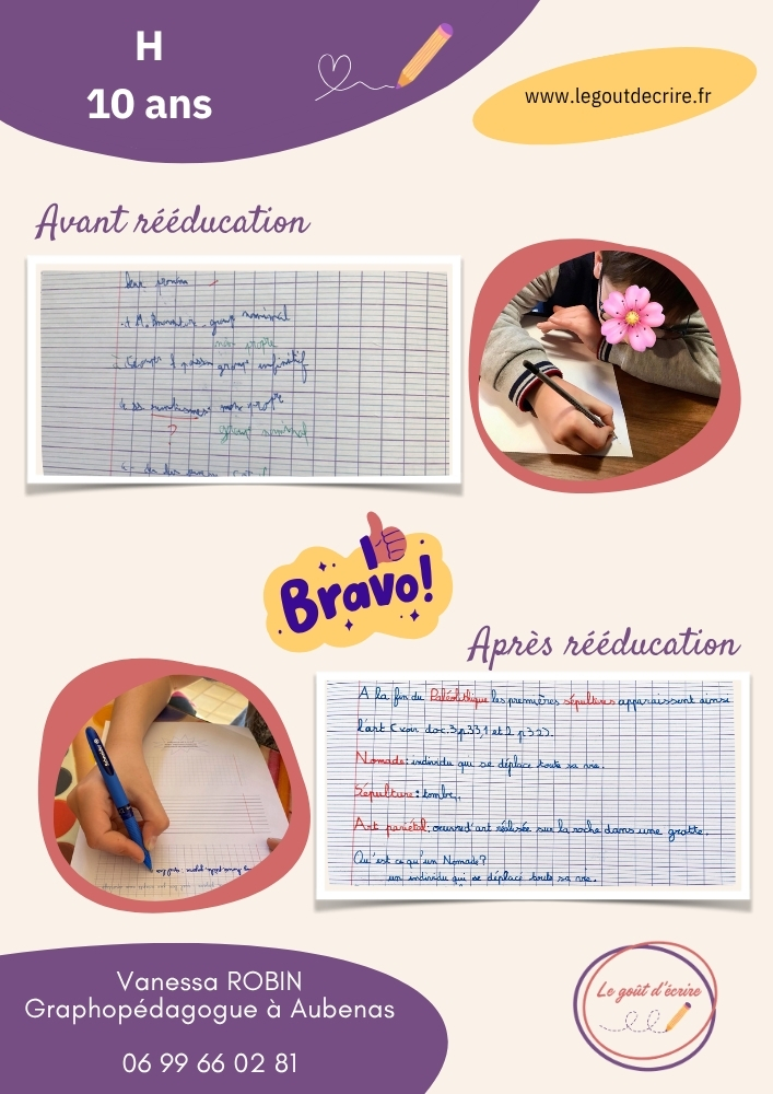 Les progrès de H. 10 ans, après 9 séances de rééducation...